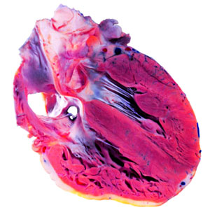 Image heart-cross-section